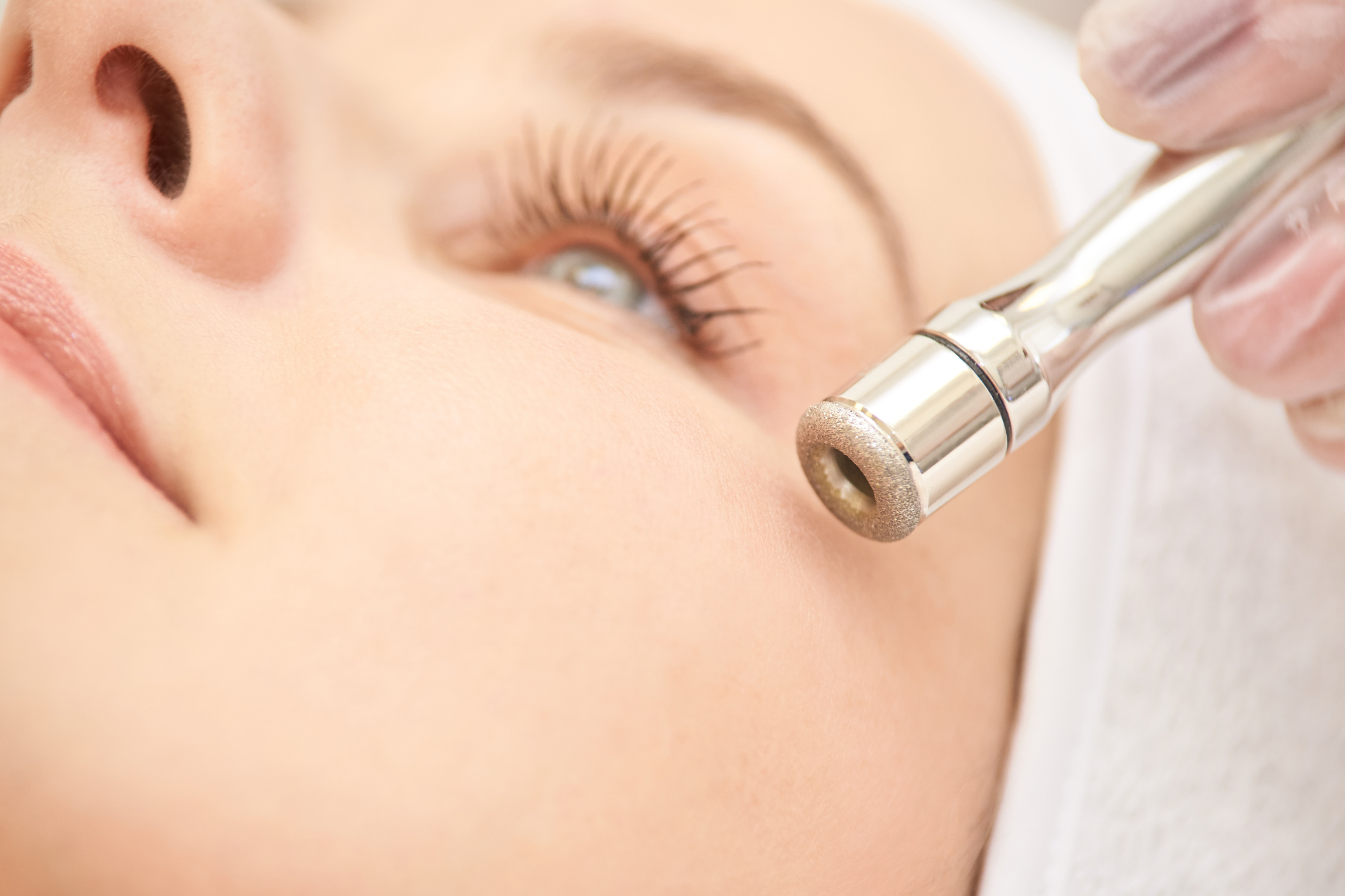 Close-up of a Microdermabrasion Treatment 